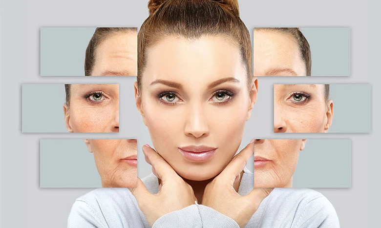 انواع چروک های پوستی