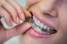 تفاوت بین ارتودنسی ثابت و متحرک چیست؟