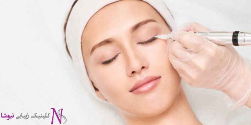 پروفیس صورت راز جوانی طبیعی بدون تزریق ژل و بوتاکس