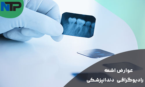 عوارض اشعه رادیوگرافی دندانپزشکی