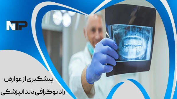 پیشگیری از عوارض اشعه رادیوگرافی دندانپزشکی