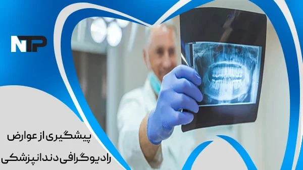 پیشگیری از عوارض اشعه رادیوگرافی دندانپزشکی