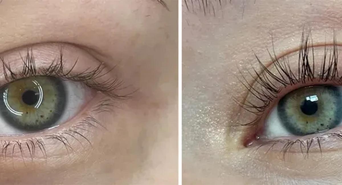 آماده سازی قبل از مصرف