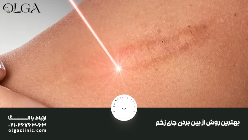 بهترین روش از بین بردن جای زخم