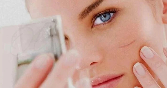 درمان | روغن بهترین روشها برای از بین بردن جای زخم